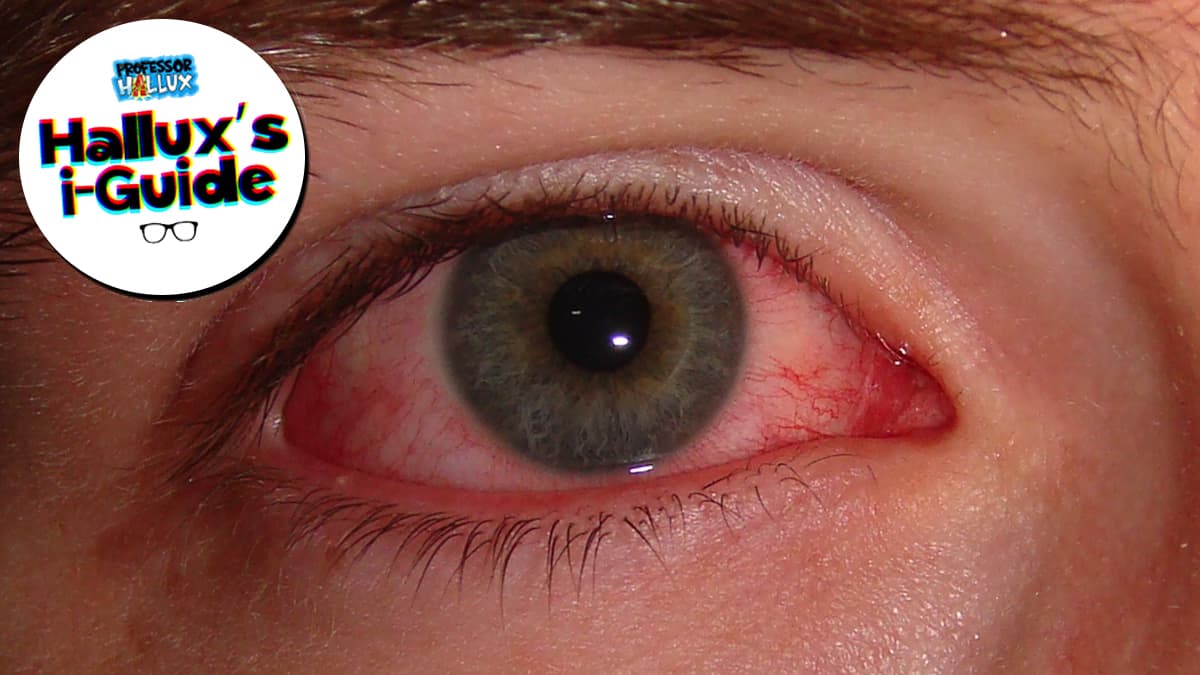 hallux-s-i-guide-what-is-conjunctivitis-fun-kids-the-uk-s